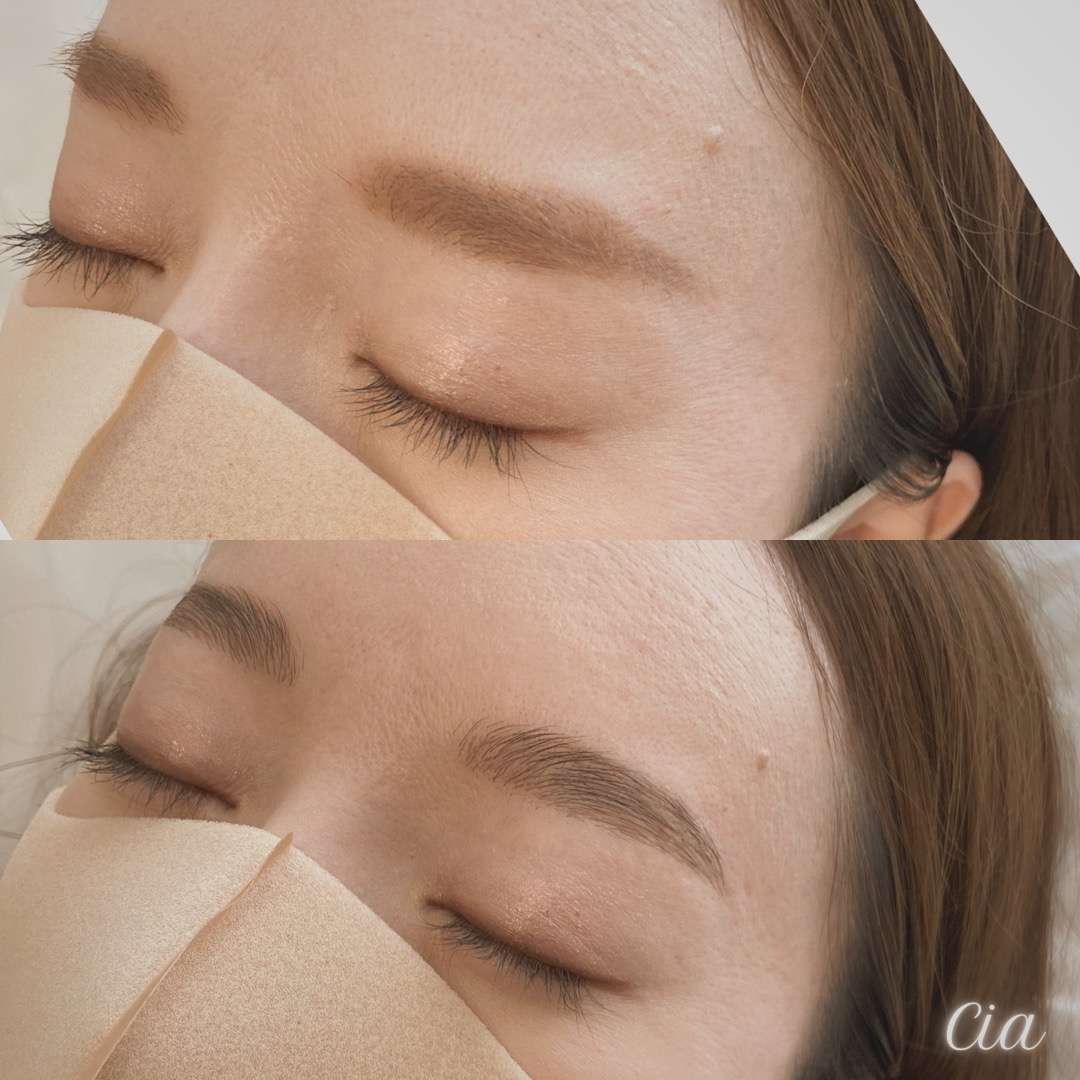 ハリウッドブロウリフト