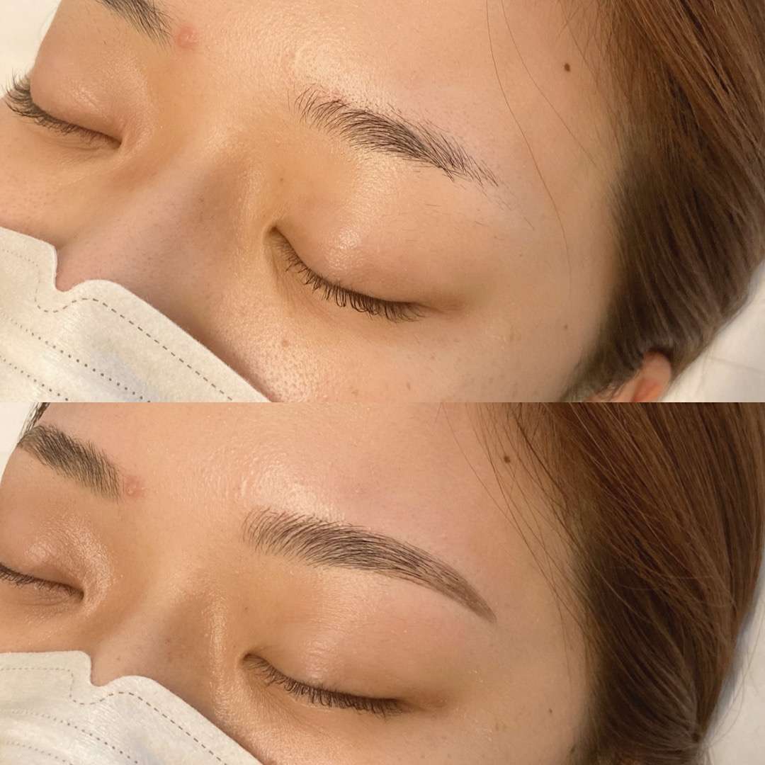 ハリウッドブロウリフト